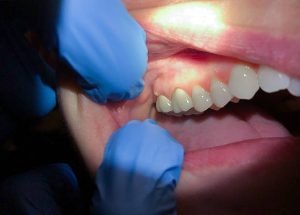 Best Same-Day Emergency Dental Services in Mounds View, MN