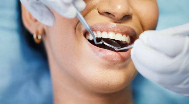 Best Emergency Root Canal Treatment in Mounds View, MN