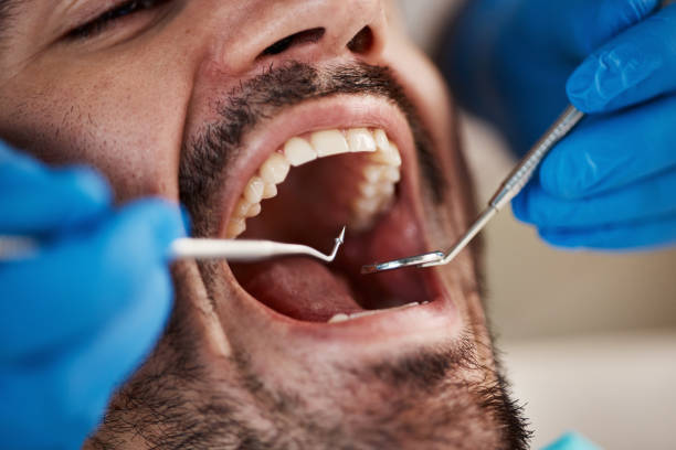 Best Urgent Care for Lost Fillings or Crowns in Mounds View, MN